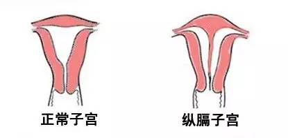 房间装修设计图_房间装修效果图_宝宝房间装修